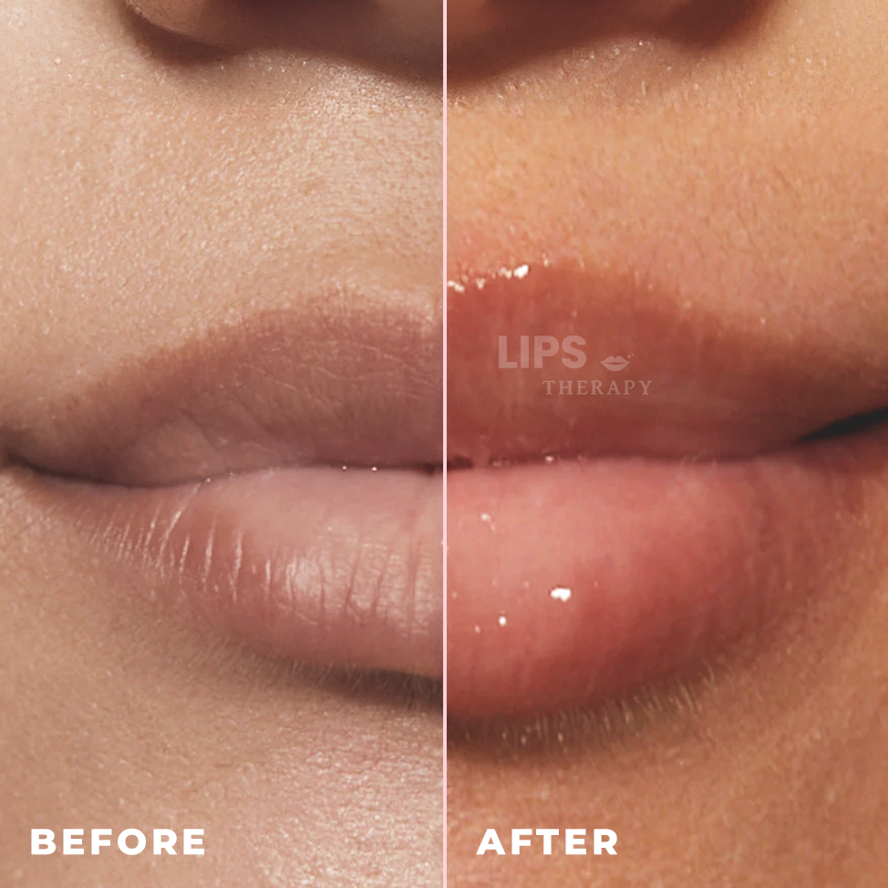 Lips Therapy Lippenserum